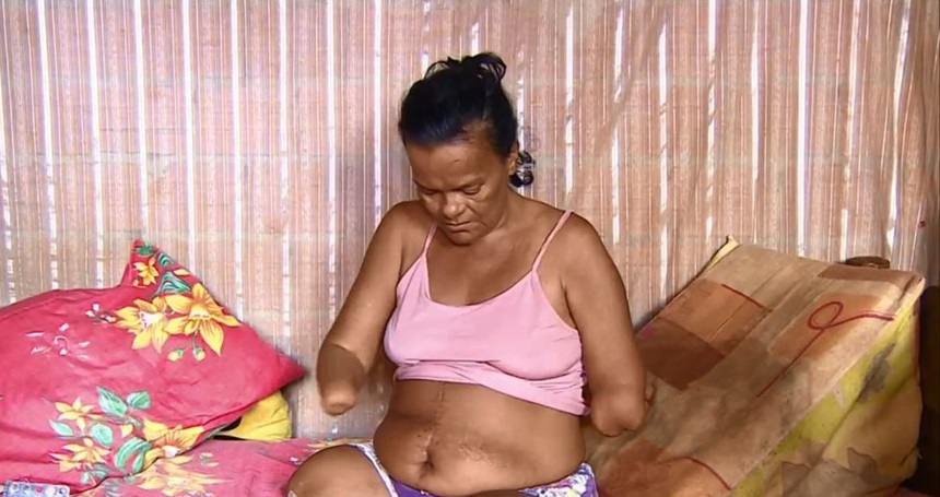 Mulher sem mãos e pernas tem pedido de benefício negado pelo INSS por não poder assinar papel, em RO