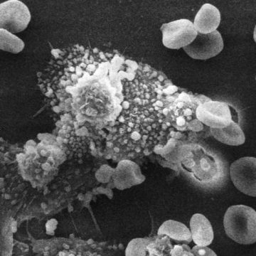 Por acidente, cientistas descobrem célula que pode ser a cura para vários tipos de câncer