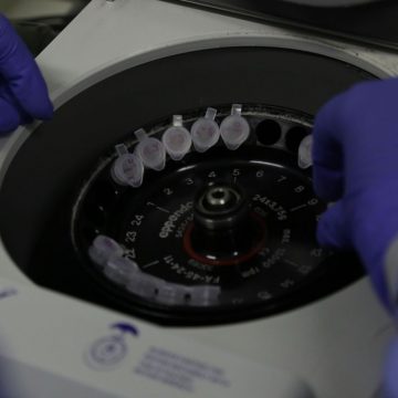 Número de casos investigados de coronavírus no Brasil cai para quatro