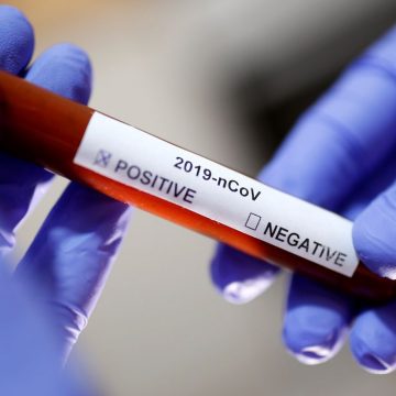 Brasil já tem 63 mortos por coronavírus