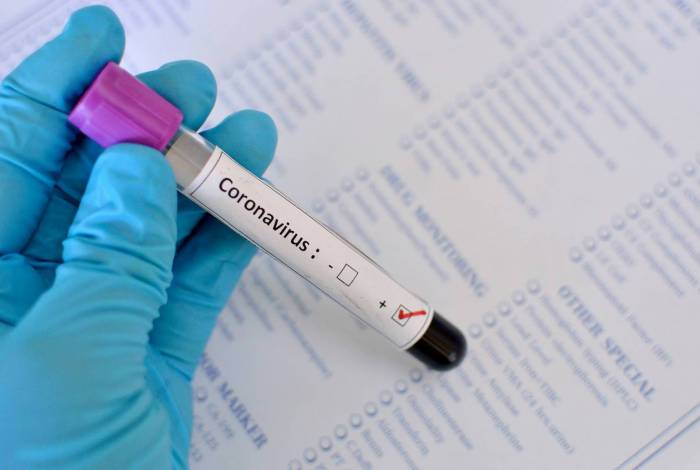 Brasil tem mais de 1,9 mil mortes e 30.425 casos confirmados de coronavírus