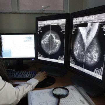 Outubro Rosa: saiba como fazer mamografias gratuitas no RJ