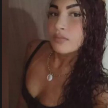 VIOLÊNCIA:"Mulher é baleada na cabeça durante briga com o namorado na Baixada Fluminense"