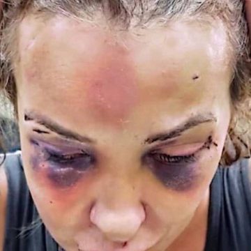 Polícia prende homem que torturou namorada com cassetete e soco-inglês por três dias em Copacabana