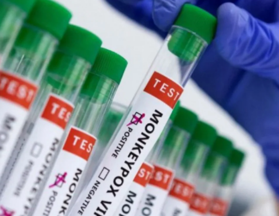 Alerta:”Cinco casos de varíola dos macacos são investigados na baixada fluminense”